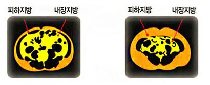 광동제약 다이어트 가르시니아 선착순 무료증정 이벤트실시