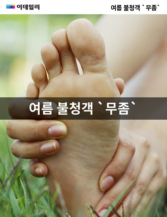  여름 불청객 `무좀`.. 피하는 방법은?