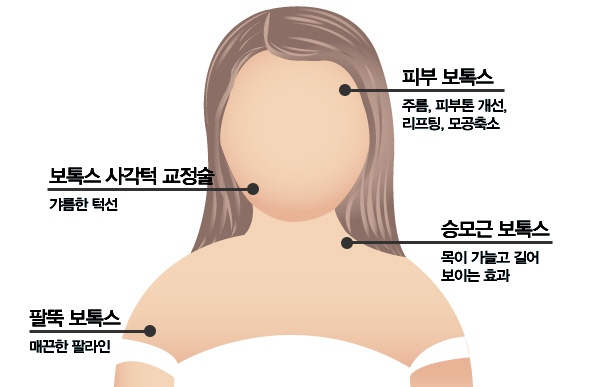 웨딩시즌 신풍속, '예비신부 필수주사 5종'이 유행