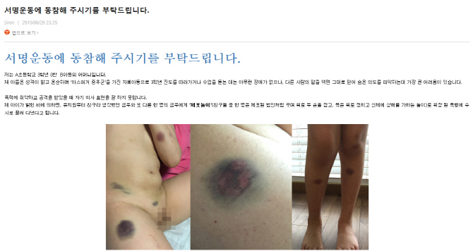 "발달장애 초등생, `체포놀이`서 늘 범인, 성기 잡아뜯겨".. 인터넷 시끌