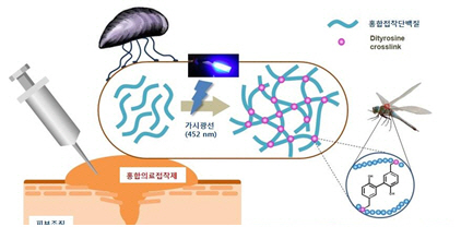 홍합으로 만든 접착체로 수술부위 봉합