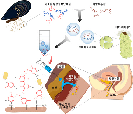 홍합,갯지렁이로 대장 수술부위 봉합한다