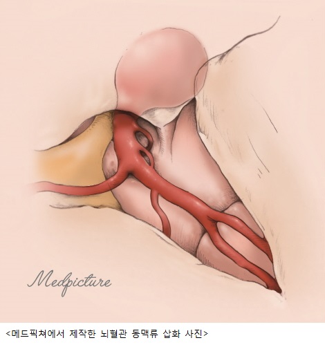 의학 삽화 제작에 전문가 참여해야.. 전문성과 환자 이해도 ↑