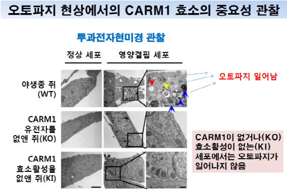 "국내연구진, 암 치료에 필수적인 오토파지 조절 신호 세계최초 규명"