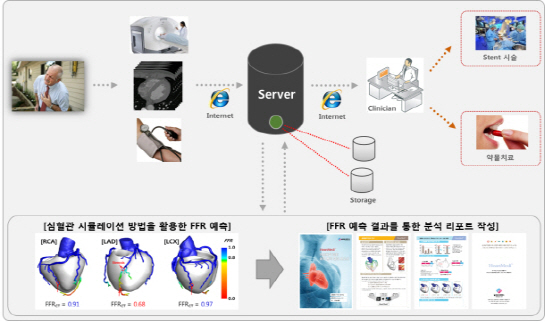 약물투입·와이어 삽입없이 관상동맥 질환 예측한다