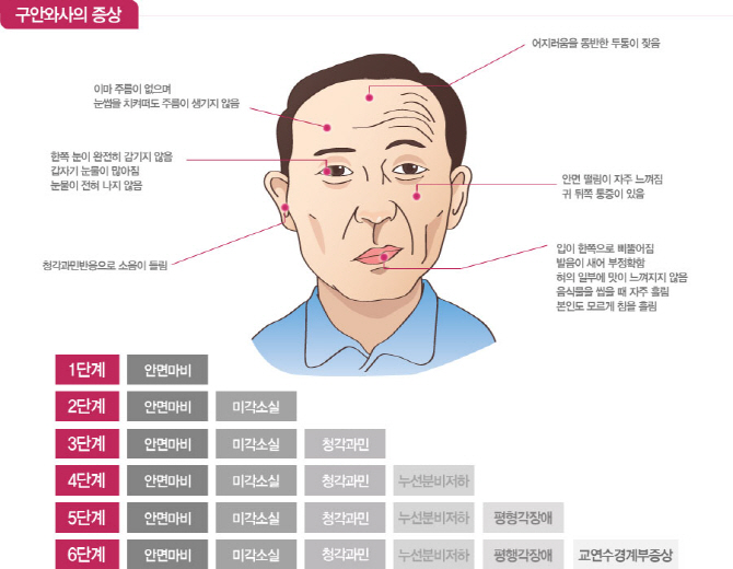 "구안와사, 체질에 따른 맞춤 치료해야"