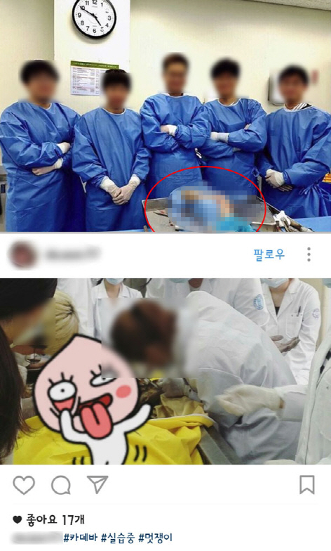 해부용 시신 `카데바` 인증사진 촬영한 의사들..SNS 게시까지