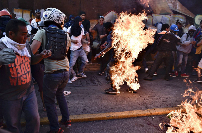 베네수엘라 반정부 시위중 21세 男에게 불붙여..총 사망자 48명