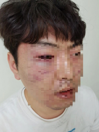 警, 범인 오인 '엉뚱한 시민' 폭행 논란 공식 사과