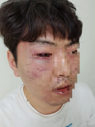 警, 범인 오인 '엉뚱한 시민' 폭행 논란 감찰 착수