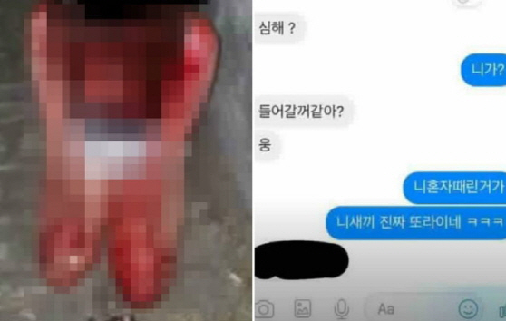 피투성이가 된 소녀들…도넘은 `말죽거리 잔혹사`