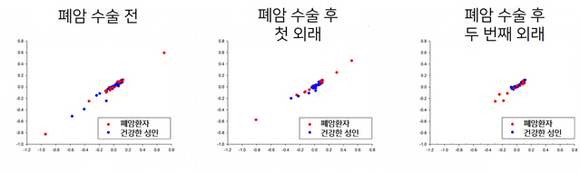 조기 진단 치료가 중요한 폐암... 숨만 쉬어도 되는 검사법 개발