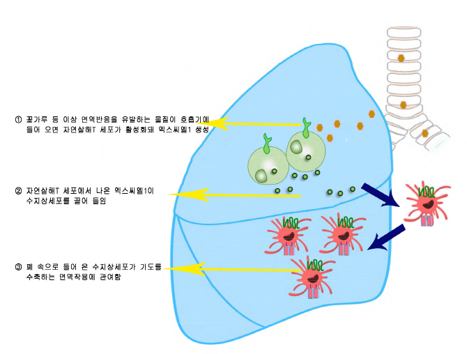 국내 의료진 천식일으키는 중요 원인 규명