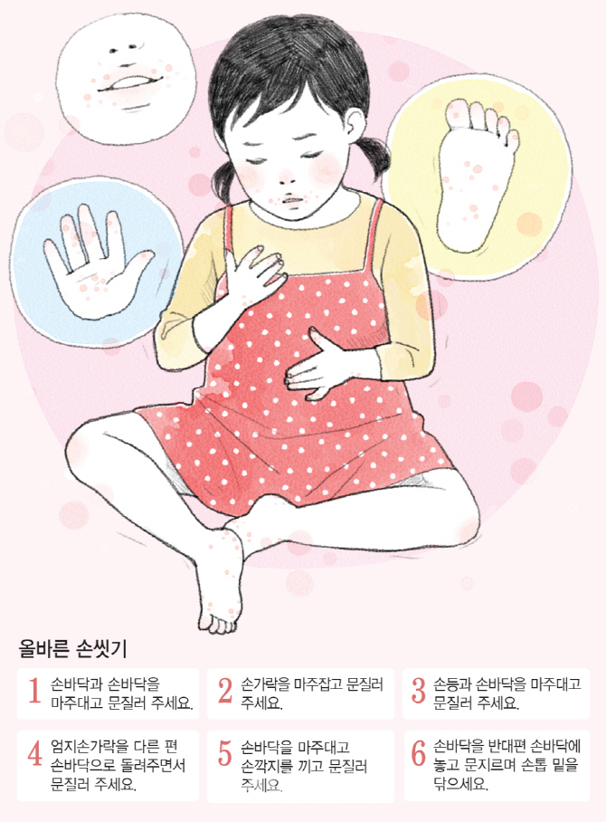 "우리 아이 입안에 물집이…" 손씻기로 수족구 예방