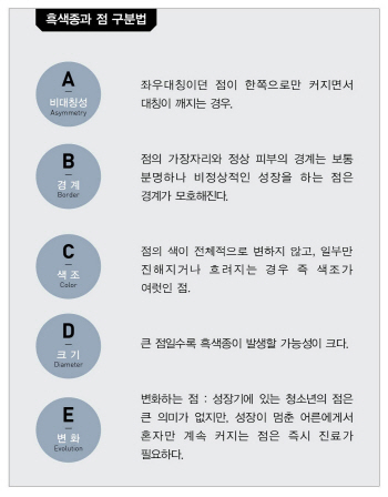 검버섯인줄 알았는데…흑색종 등 피부암 '주의'