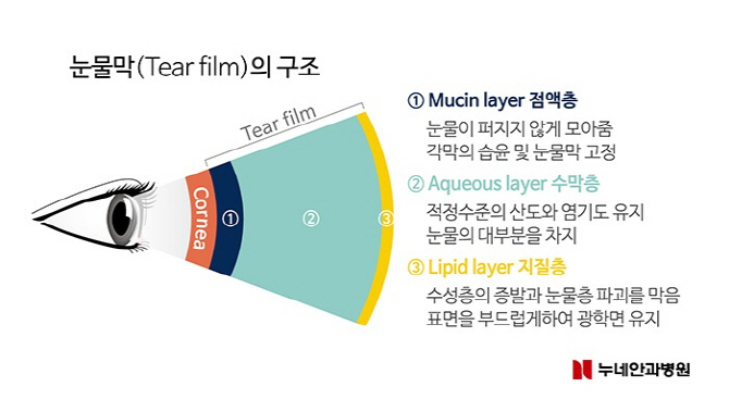 과도한 안구 세척, 안구건조증·각막염 '주의'