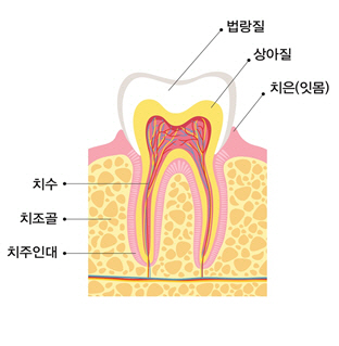 참다 참다 치과가면 때는 늦어...영구치 정기적 관리 중요