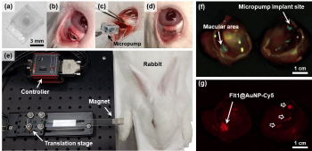 'KEIT 지원' 서강대·대구카톨릭대, 획기적 '망막질환 치료법' 개발