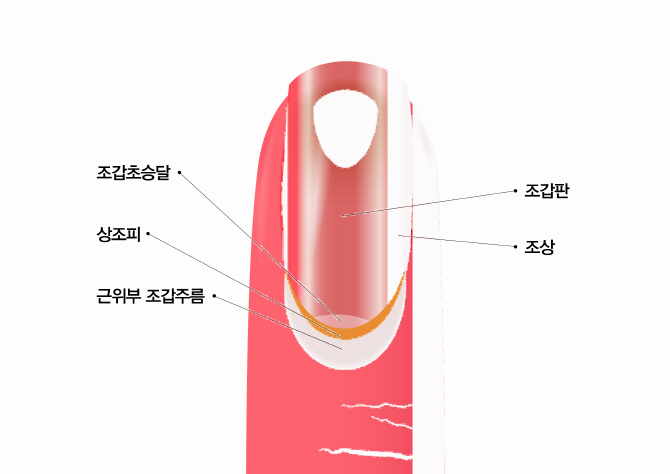 내 손톱 안전한가…쉽게 부러지는 손발톱 '조갑연화증'