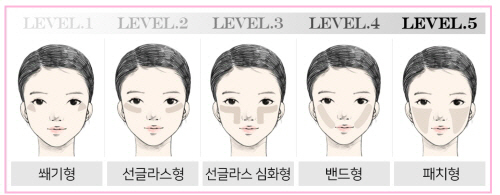 여름철 짙어지는 기미, 유형만 5가지 … 피부톤 맞춤치료 핵심