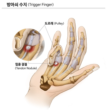 사격, 아시안게임 빛낸 '한 발의 승부'... 스포츠 사격엔 주의 할 점도