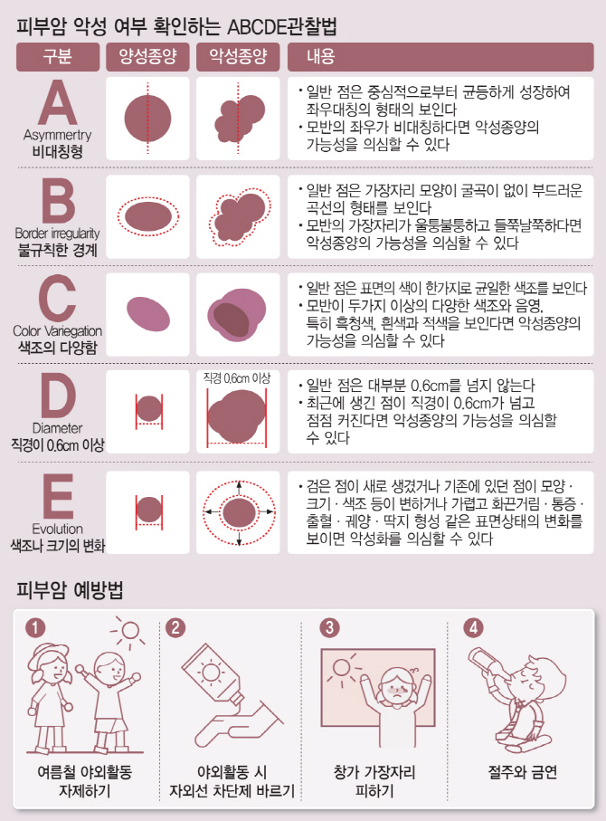 휴가 때 생긴 검푸른 점…울퉁불퉁 커지면 '악성흑색종' 의심