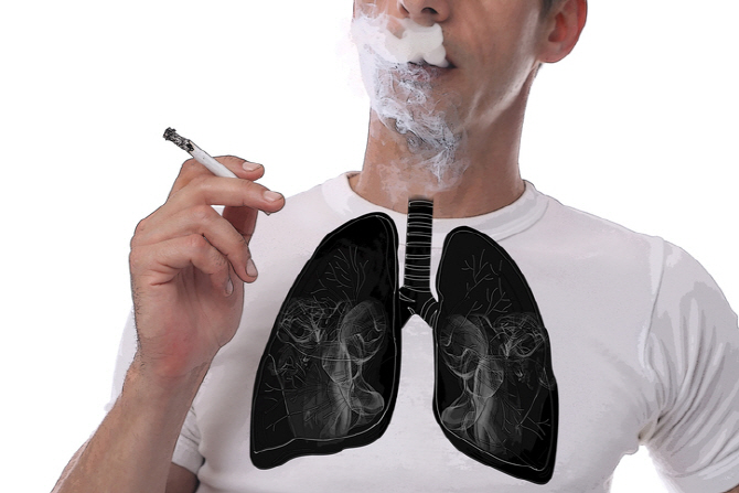 호흡곤란·기침 증상 만성 폐쇄성폐질환 "금연이 답"