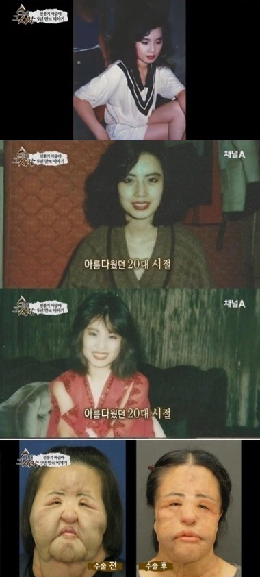 ‘선풍기 아줌마’ 별세…‘한국의 브룩 쉴즈’라 불렸던 성형 전 모습