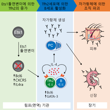 국내 연구진, 난치성 자가 면역질환 '루푸스' 발병 원인 찾았다