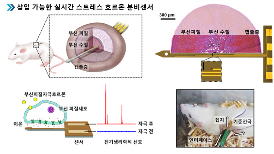 국내 연구진, 체내 삽입형 스트레스 호르몬 센서 개발