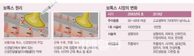 근육 마비가 보톡스 원리,두통 알러지등 부작용도 주의해야