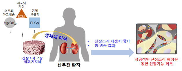 국내 연구진, 신장조직 모방 생분해성 지지체 개발…조직재생 효과↑