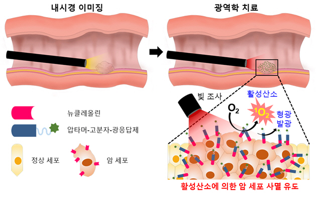 국내 연구진, 내시경 암 진단·치료 효과 높이는 소재 개발