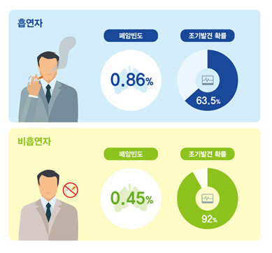 비흡연자 폐암, 저선량 흉부 CT로 조기진단... 생존율 높인다