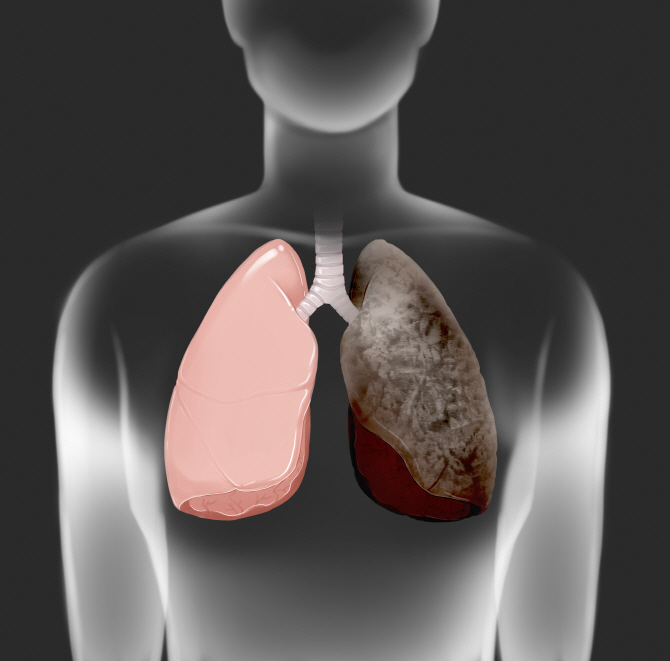 암중 폐암이 사망률 1위... 건강한 폐를 위한 생활습관은?