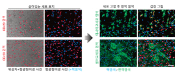 뇟속 청소부 추적해 치매 치료 길 연다