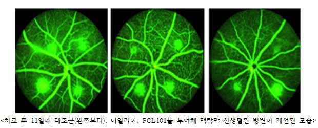 시선테라퓨틱스, 황반변성 치료 신물질 비임상서 효과 입증