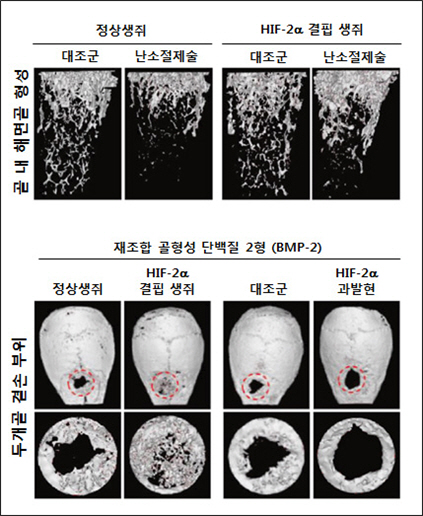 국내 연구진, 뼈 항상성 조절 관여 핵심인자 발견