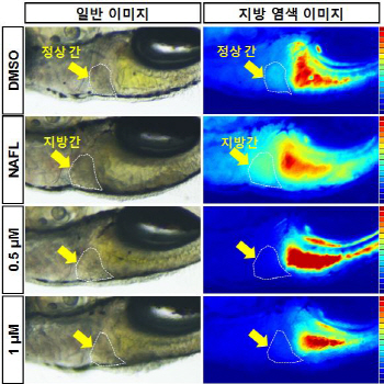 화학硏, 세포 청소부 '오토파지' 조절 간경변 치료제 신약 후보물질 개발