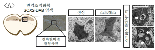 DGIST, 만성 스트레스로 인한 뇌 손상 비밀 밝혀