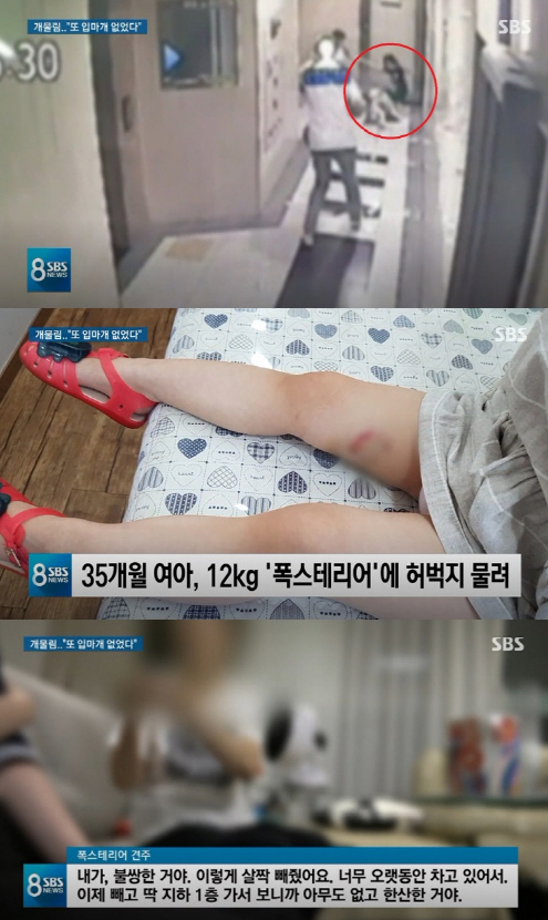 4살 아이 물어뜯은 폭스테리어…견주 “불쌍해서 입마개 빼줬다”