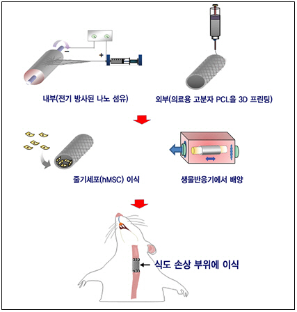 인공장기 개발, 또 한 걸음 앞으로 전진