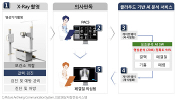 LG CNS, 'AI 보건소' 만든다..엑스레이 영상 판독해 만성질환 관리 강화