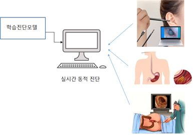 국내 연구진, 세계 최초 내시경 데이터 증강기법 이용 후두암 조기진단 플랫폼 개발