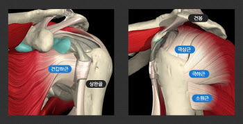 아니 벌써 오십견... 오십견과 착각하기 쉬운 이 질병은?