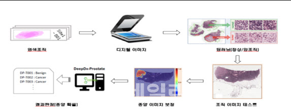 인공지능(AI) 기반 암진단 소프트웨어 국내 최초 허가