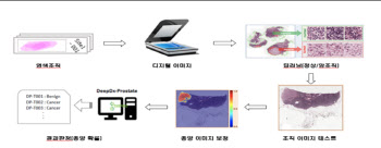 인공지능(AI) 기반 암진단 소프트웨어 국내 최초 허가