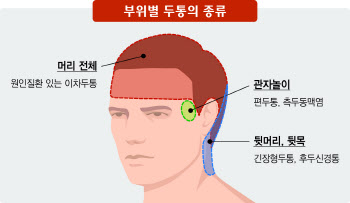 두통 지속되면 꼭 진료받아야... 아픈 부위·증상 따라 질환도 달라