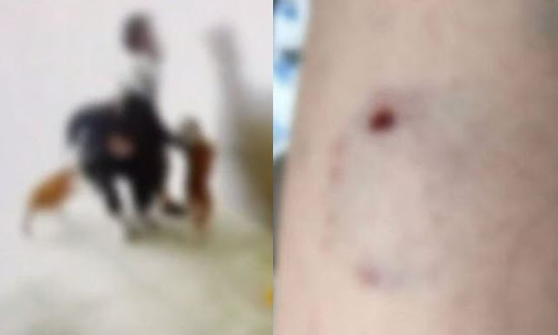목줄 없던 불도그 두 마리..."점프해서 허벅지 물고 안 놓아"