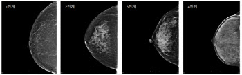 해외보다 국내 여성 빌생 비중 높은 치밀유방.... 유방암 위험 높아 정기검진 필수